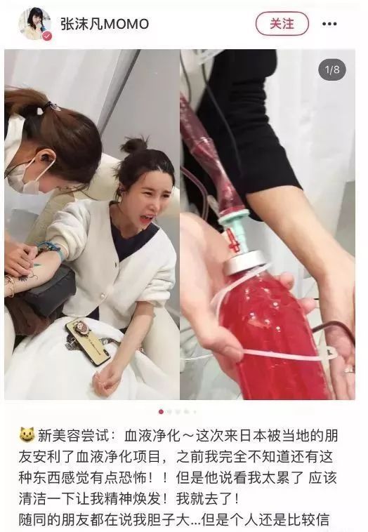 换血能不能保持年轻,换血能年轻