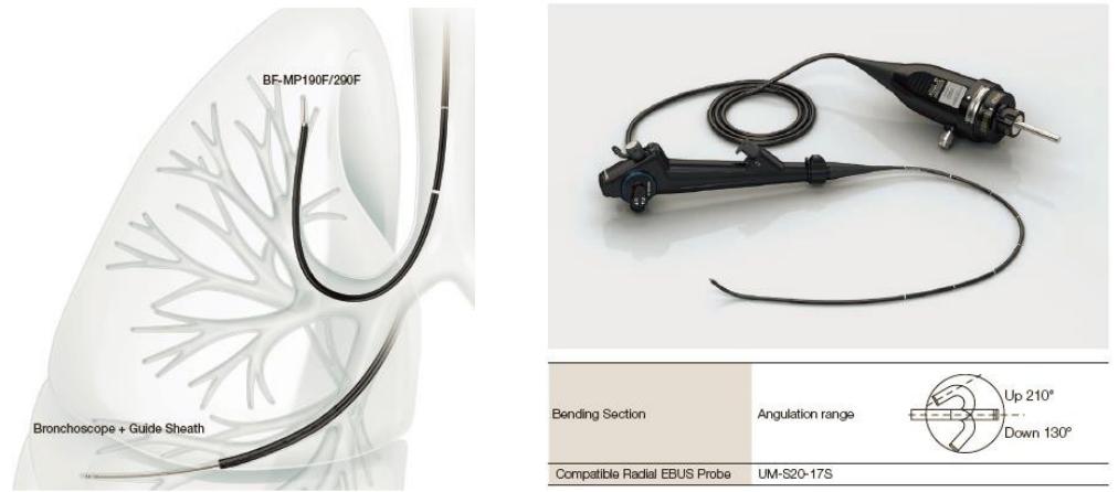 孙加源门诊,治疗肺癌的新技术新手段