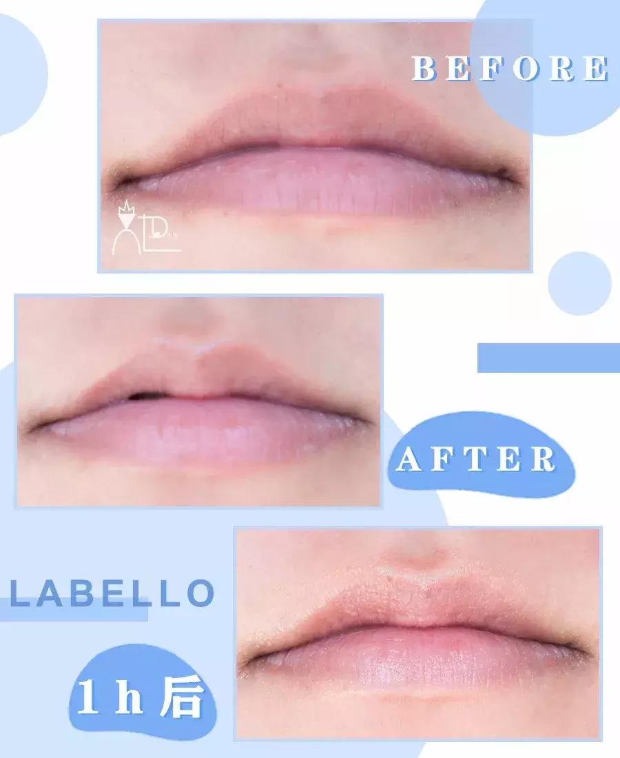 拯救沙漠唇秋冬润唇膏大推荐,品牌润唇膏保湿防干裂第一名