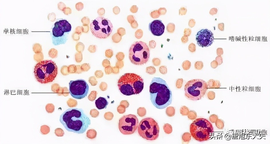 白细胞低吃什么补最快,甲亢白细胞低怎么调理