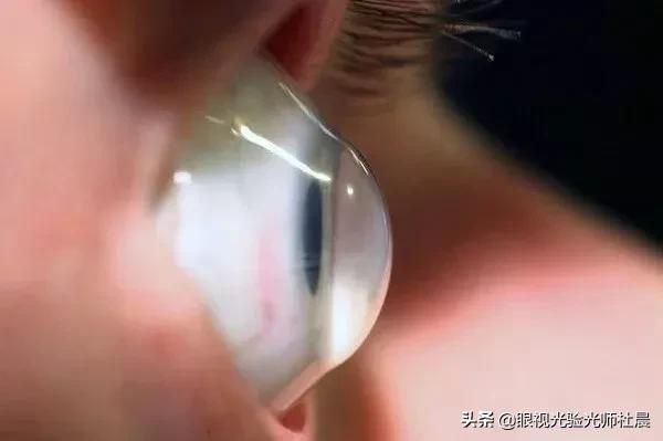 近视手术smart和全飞秒激光哪个好,400至500度的近视手术要多少钱啊