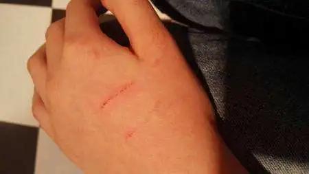 被猫抓出血了要不要打狂犬,被家猫抓伤出血要打狂犬疫苗吗