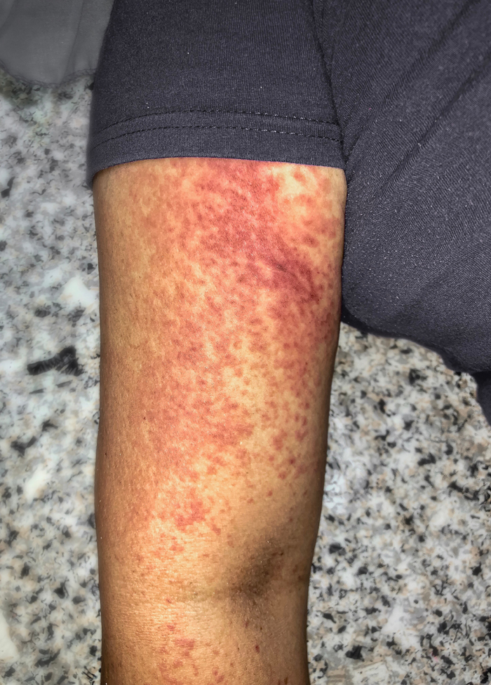 警惕这种“网红产品”不要随便买,警惕这种药千万别乱吃