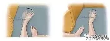 踝关节不稳的发生机制、康复训练及预防