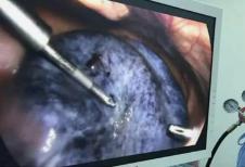 提高卵巢功能都要做什么,提高母牛养殖效益