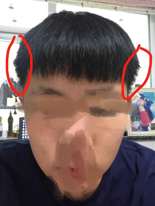 头发两侧炸毛怎么解决,男生头发两侧炸毛一招完美解决