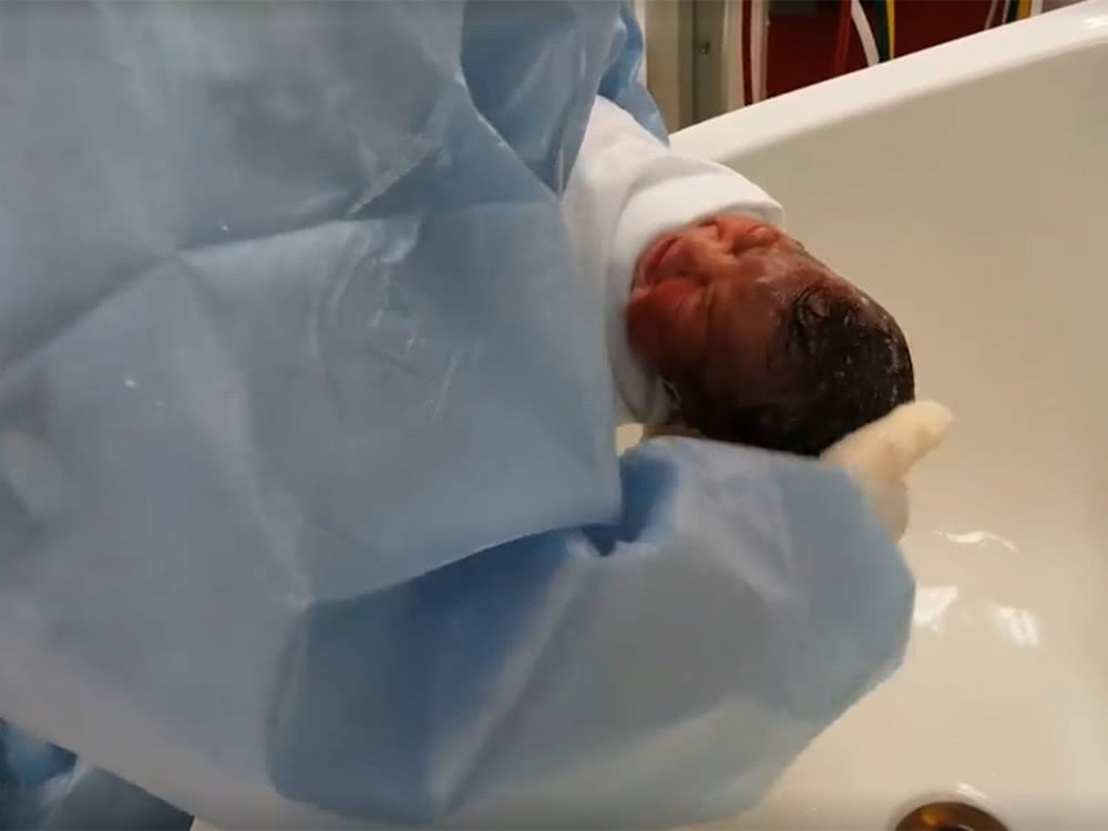 产后胎盘如何处置比较好,产后胎盘怎么办