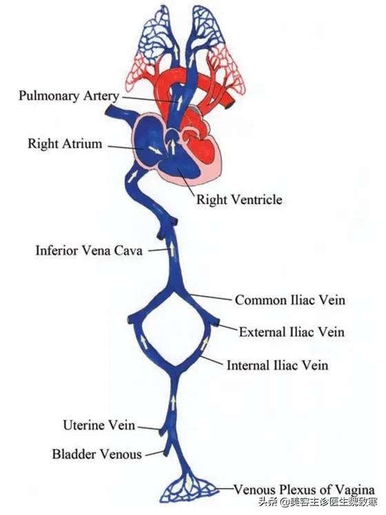 私密整形严重并发症：阴道注射填充剂9小时后永久停止呼吸