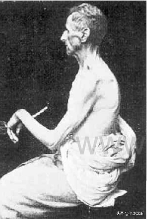 全国职业病防治法宣传周|铅中毒的预防与治疗