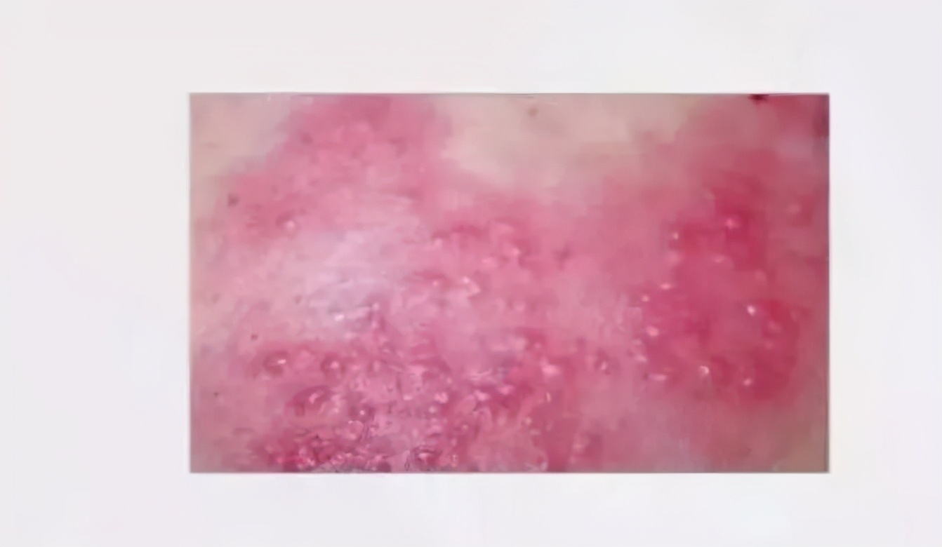 皮肤病反反复复怎么办才好,皮肤病很痒怎么办