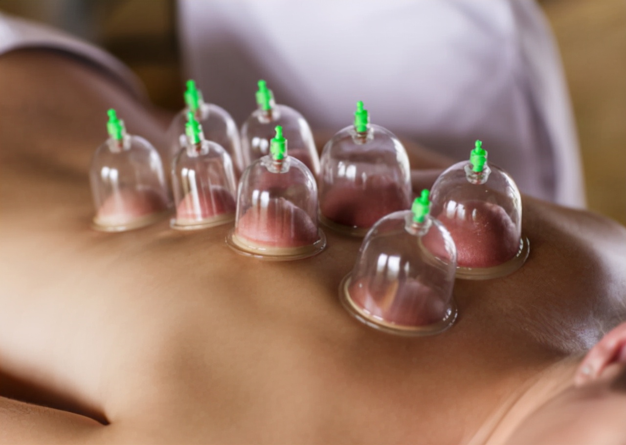 拔火罐后背会痛嘛,拔火罐后背出血泡