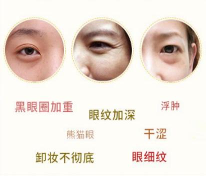 改善眼部细纹的最好方法,每天3分钟教你徒手改善眼部细纹