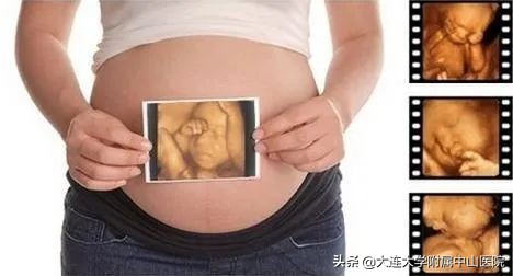 胎儿四维彩超分析的哪些内容,彩超科普知识