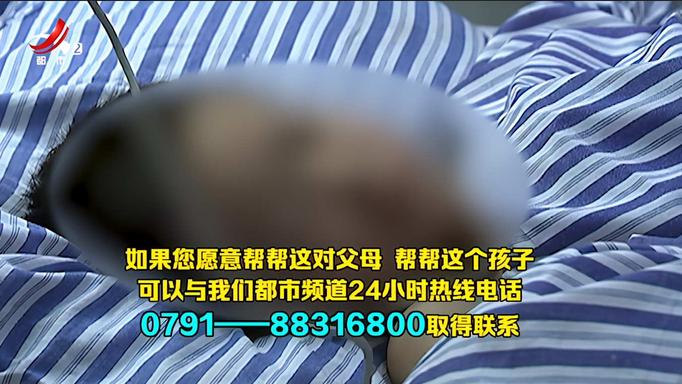 7岁男童意外电击伤右臂截肢,男童被电击右臂截肢大家捐钱