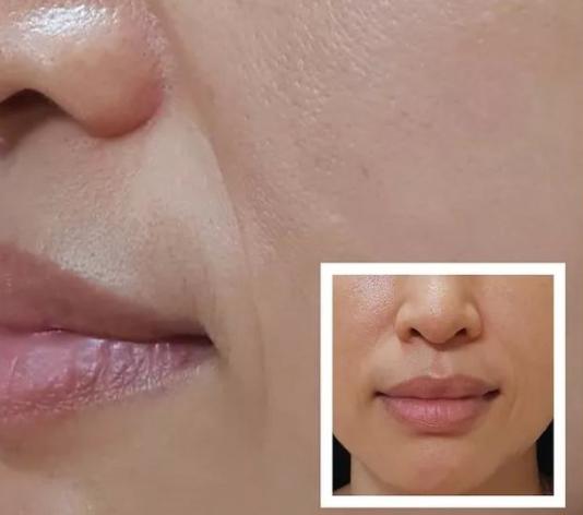 如何把法令纹变成一件高级的事