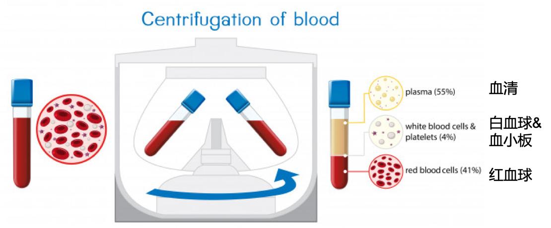 为什么输血需要配型,熊猫血配型成功