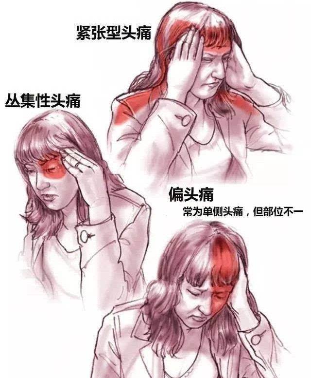 最近有没有人出现头特别疼,感觉脑壳痛的不是自己的了