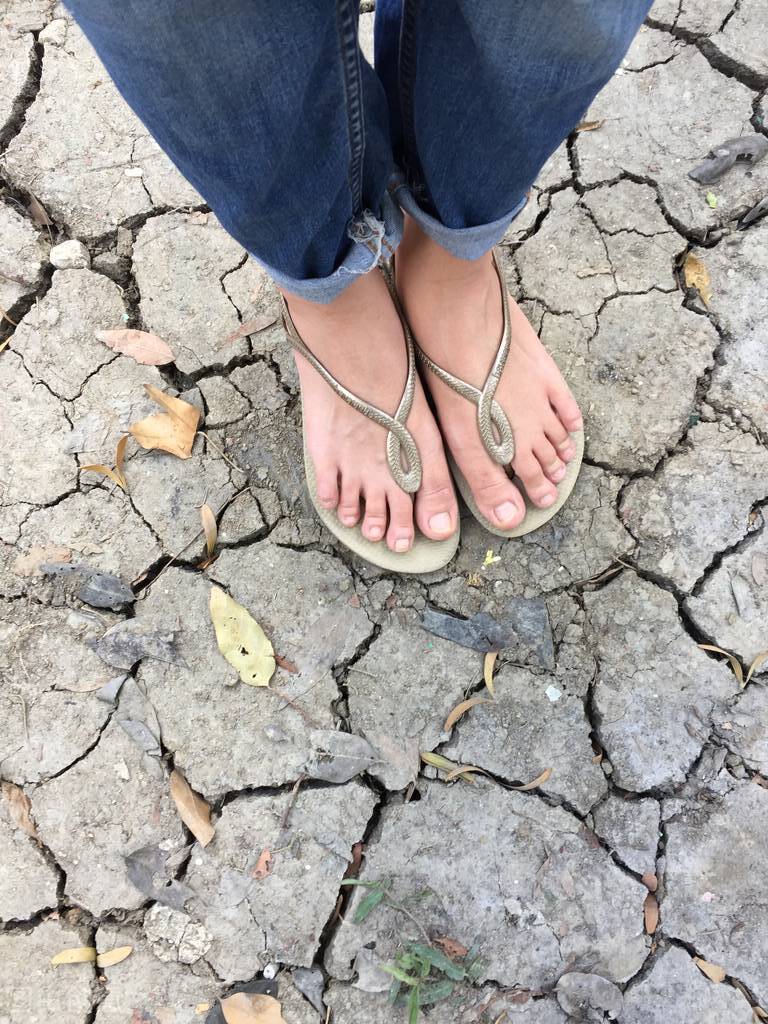 黑色素瘤与良性痣的鉴别要点,不规则的黑色素痣一定是瘤吗