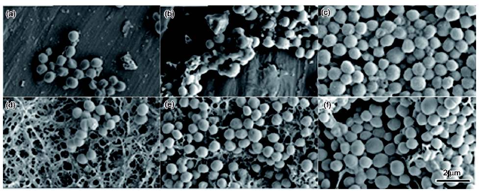 创面细菌生物膜处理方法,细菌生物膜与慢性创面感染