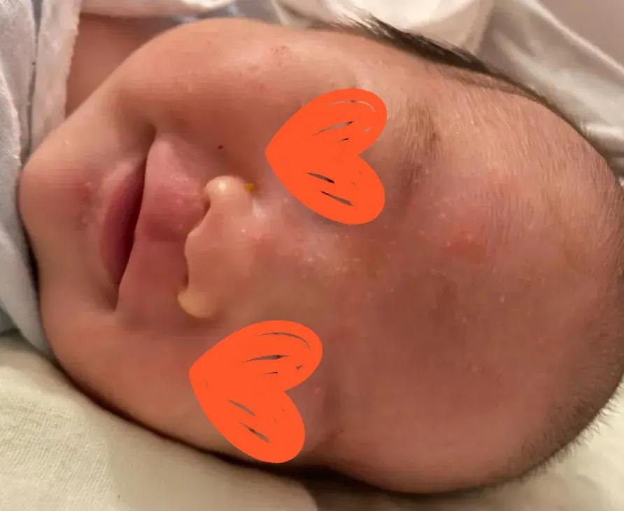 养宠物会不会造成孩子湿疹,孩子有干性湿疹能养宠物吗