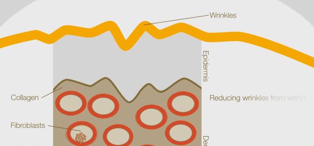 痘印反反复复怎么办,痘印一直反反复复怎么办