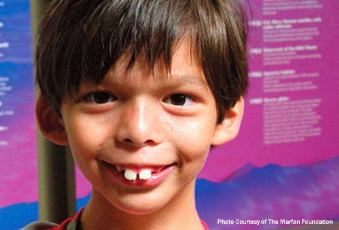 耳垂有一道折痕和心脏有关吗,耳垂有折痕一定是心脏有问题吗