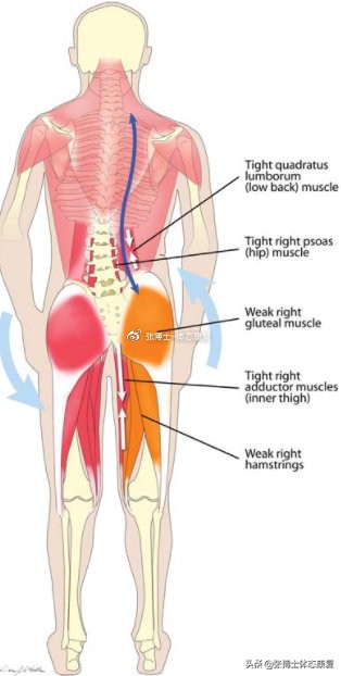 八字臀步态矫正,常见的七种异常步态矫正训练