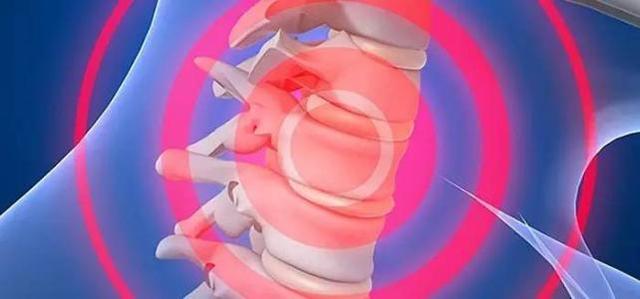 左边脖子总是跳跳疼,脖子锁骨处总是阵疼是什么原因