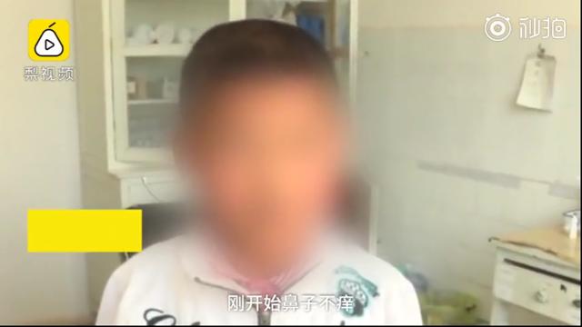 男童反复流鼻血竟是一条大蚂蝗,5岁男孩取出蚂蟥