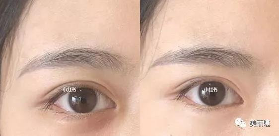 李佳琦眼部精华兰蔻,李佳琦蝶芙兰淡斑