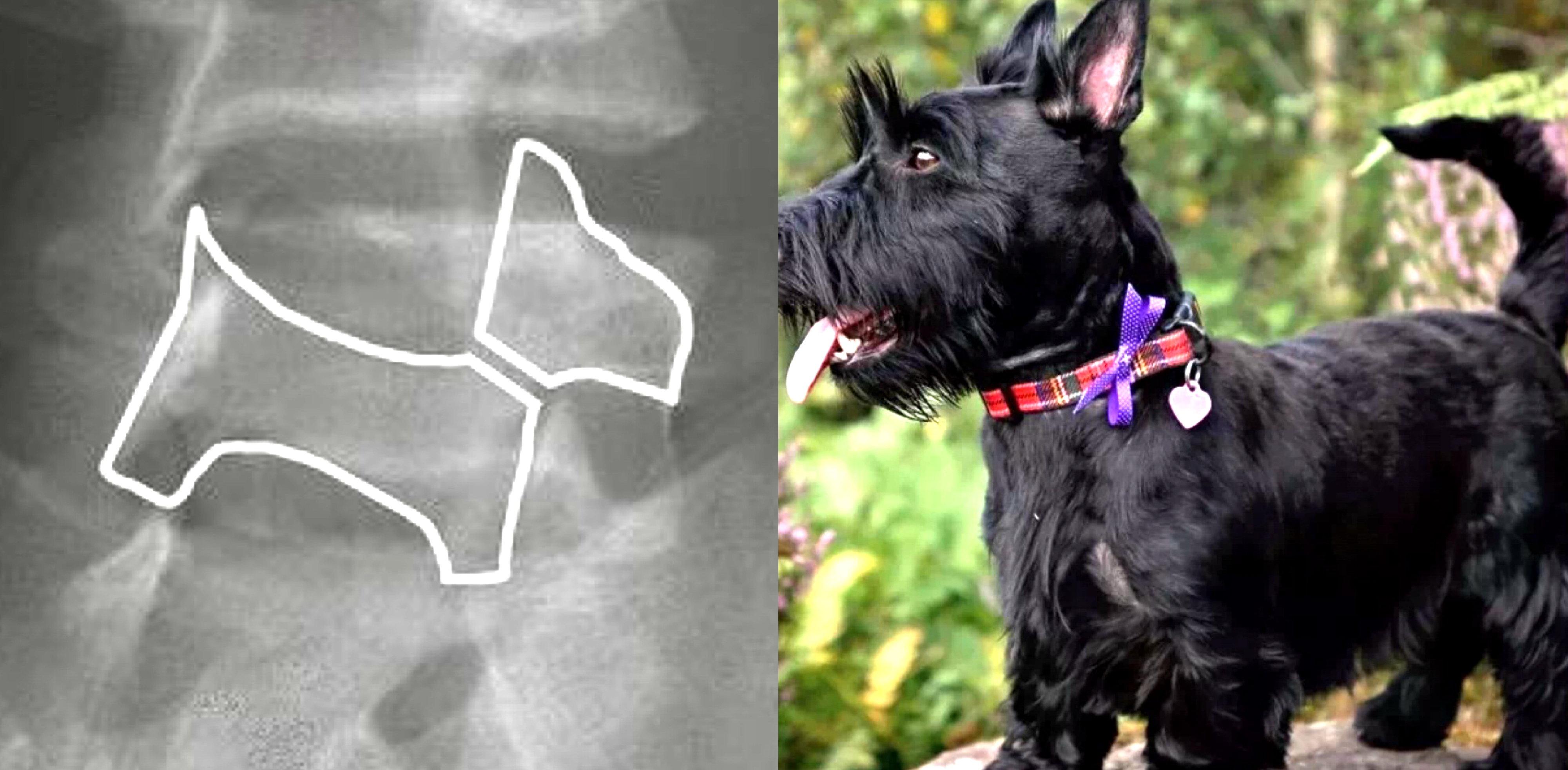 青少年脊柱弯曲危害科普视频,脊柱病科普小常识大全