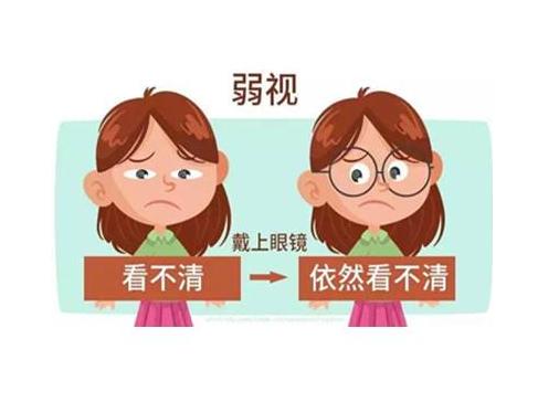 近视弱视训练加盟,视力矫正加盟怎么推广