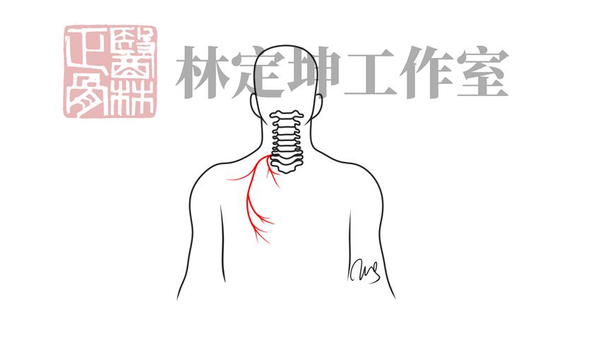 背痛中医如何调理,中医对背痛如何治疗