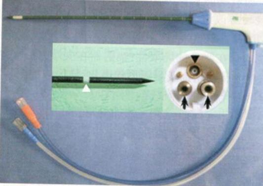 子宫肌瘤的10个前兆,子宫肌瘤有八个注意事项