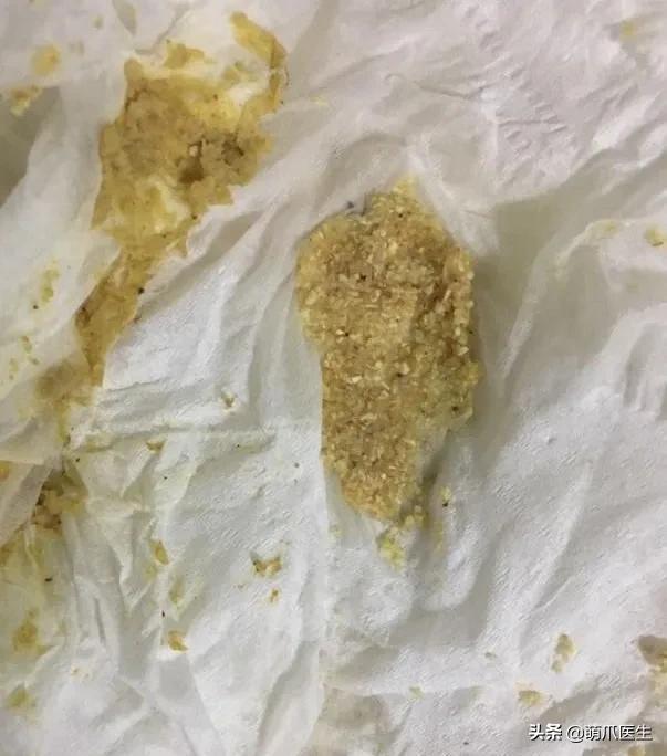 猫突然喜欢咬东西,怎么改掉猫吃猫砂的毛病