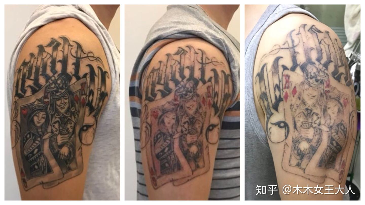 洗纹身一般要多久才能洗干净,洗纹身真的可以完全洗掉吗