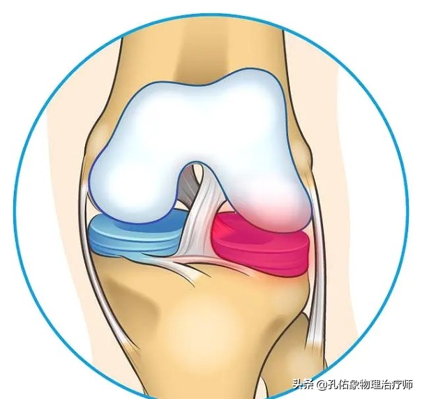 膝盖痛是什么病引起的怎么治,膝盖疼致病原因