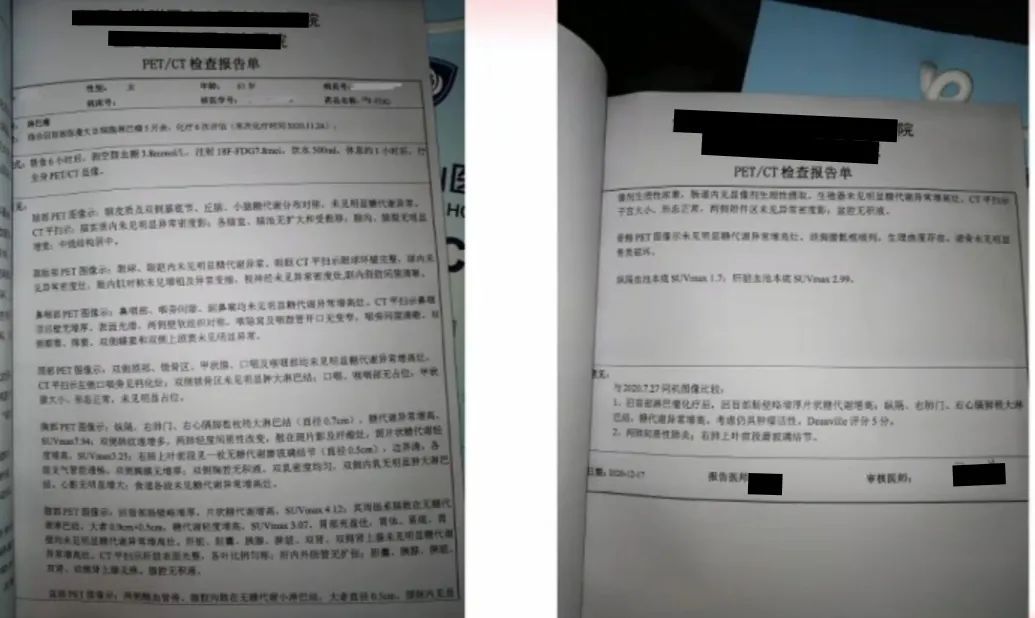 确诊淋巴瘤的最可靠依据是什么,淋巴瘤预后差有治疗必要吗