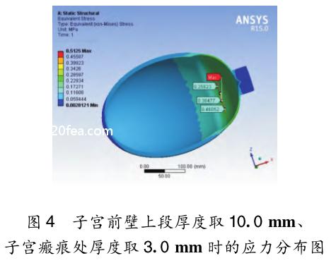 有限元应力分析结果有单位吗,产妇子宫模型