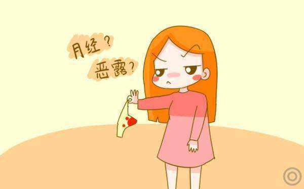 妇科阴道出血常见症状,阴道流血有什么症状表现