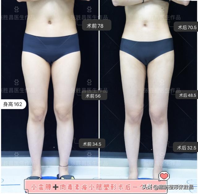 快速有效暴瘦腰腹练出马甲线,紧致身材零赘肉这样健身才最有效