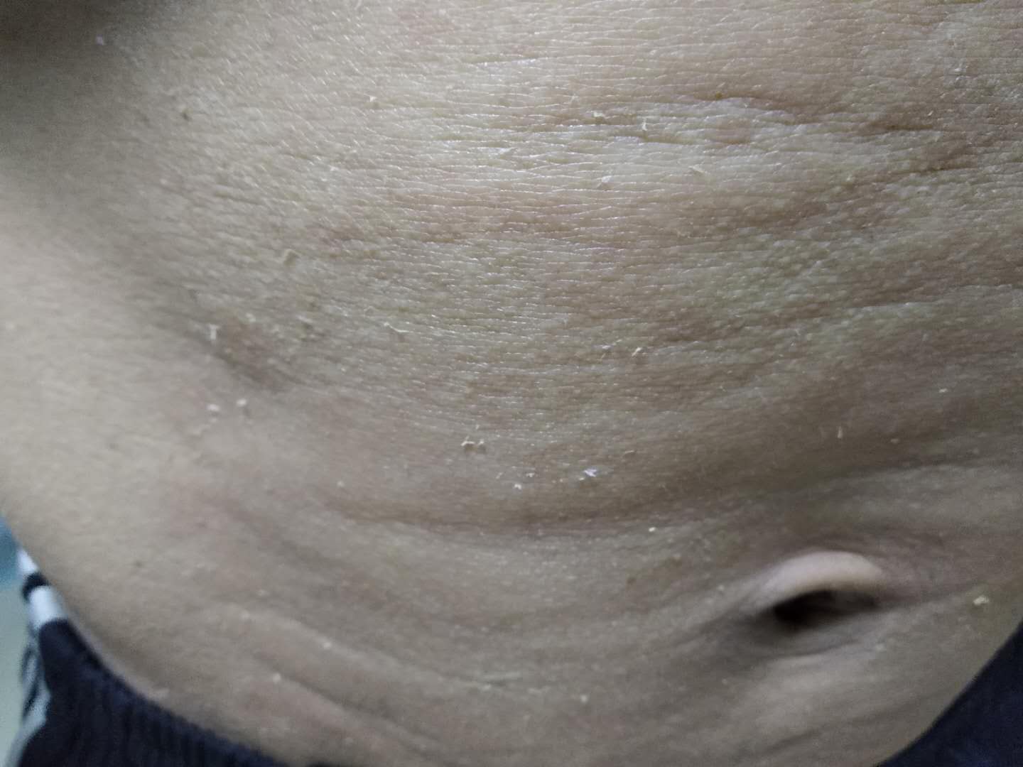 调理脾胃的外敷中药粉几点敷好,外敷调理脾胃虚寒药方