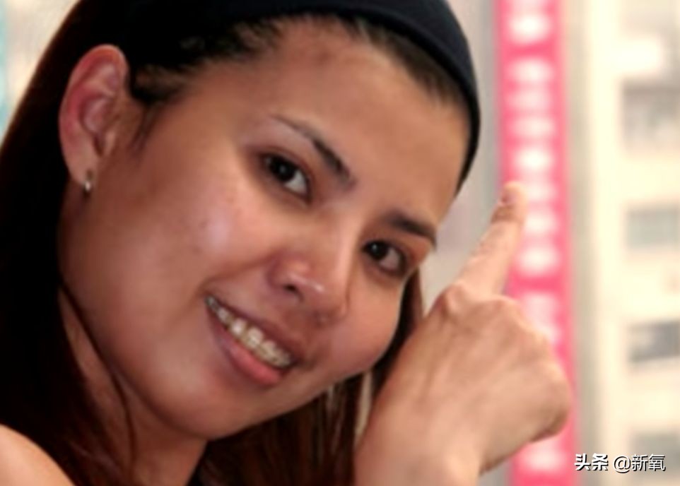 18岁土肥圆豪掷800万全身整形，鼻子6次大整假体穿出，效果却超美