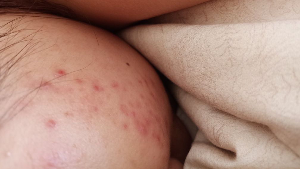 兰蔻极光水真实测评第一名,兰蔻小黑瓶和极光水