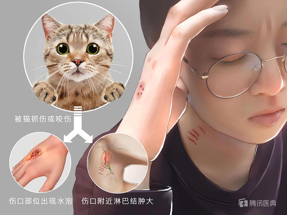 被流浪猫咬了24小时有什么事,被感染新冠的猫咬了一口