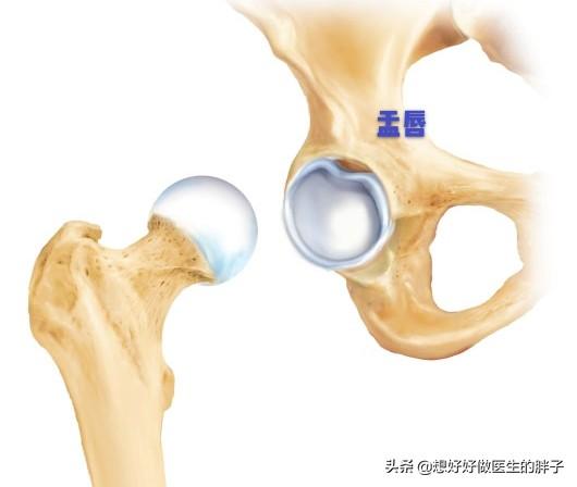 髋关节疼痛两腿不一样长如何康复,左大腿髋关节突然疼痛是什么原因