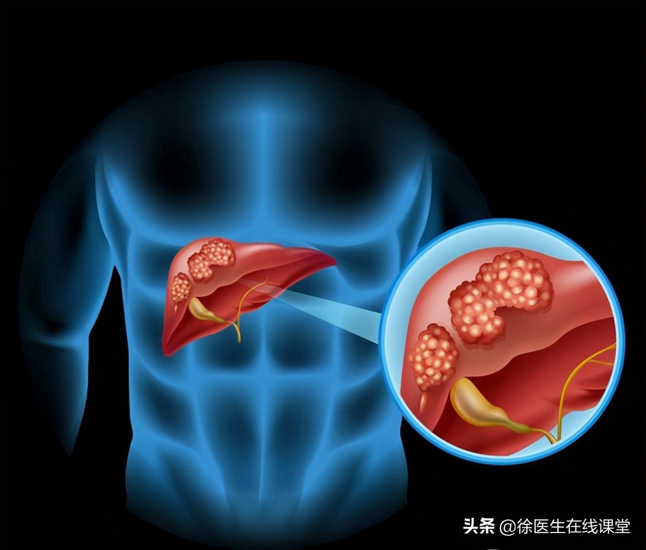 携带丙肝者能打新冠疫苗吗,有乙肝病毒携带者可以去医院吗
