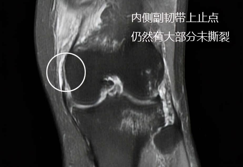 到底是手术好还是保守治疗好,保守治疗和手术治疗怎么选