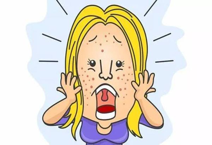 “清上畅中法”在*疮痤**治疗中的运用