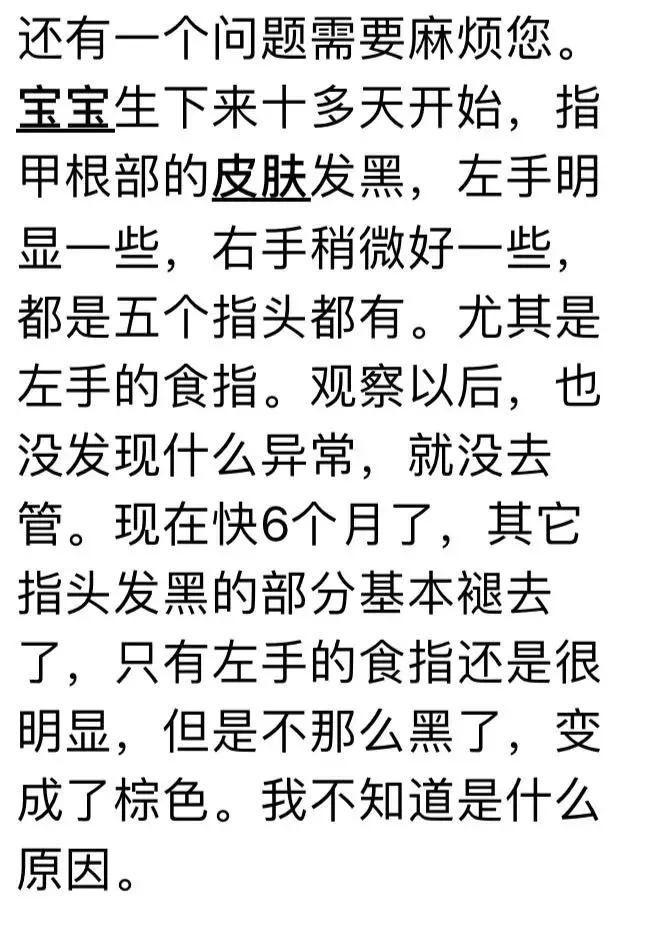 手指皮肤发黑是什么原因,手指关节处皮肤发黑发皱